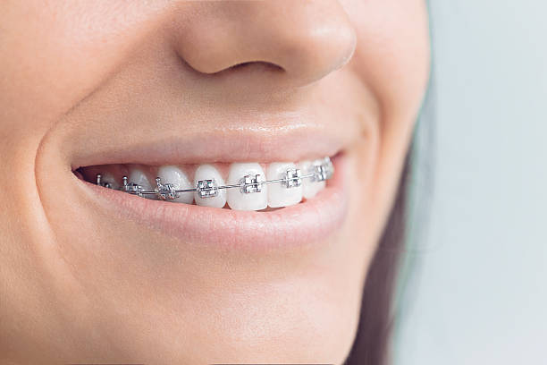 Dental Bonding in Westmont, NJ